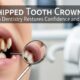 Chipped Tooth Crown: How Modern Dentistry Restores Confidence and Oral Health